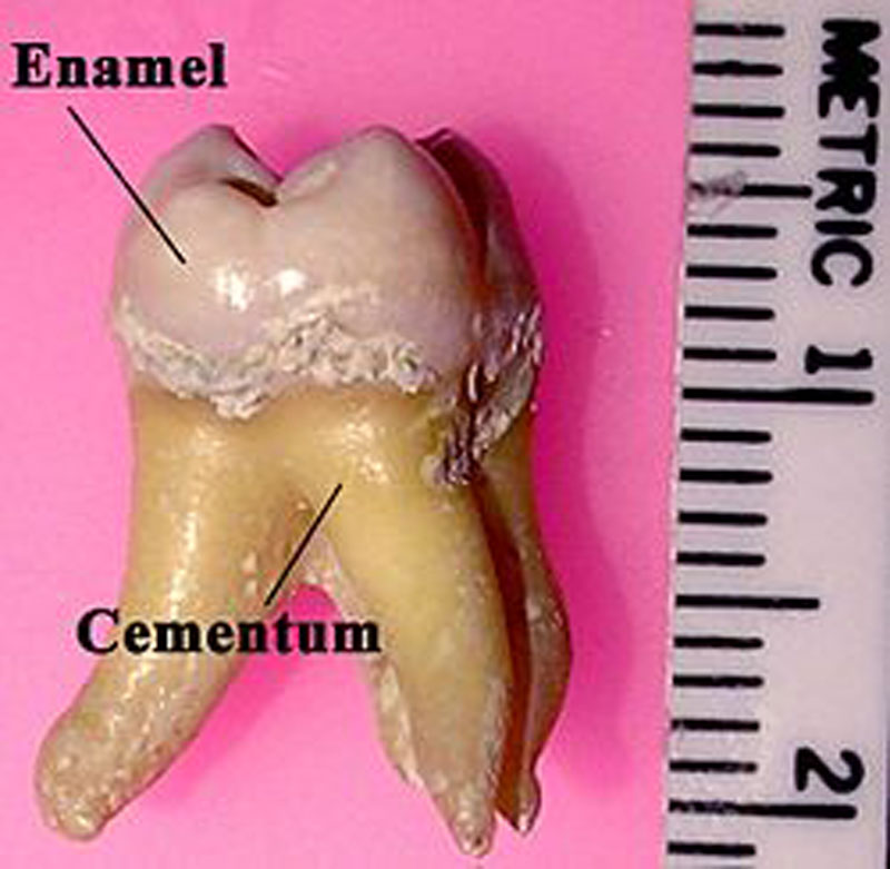 Cementum