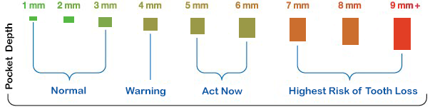 stages of gum disease chart